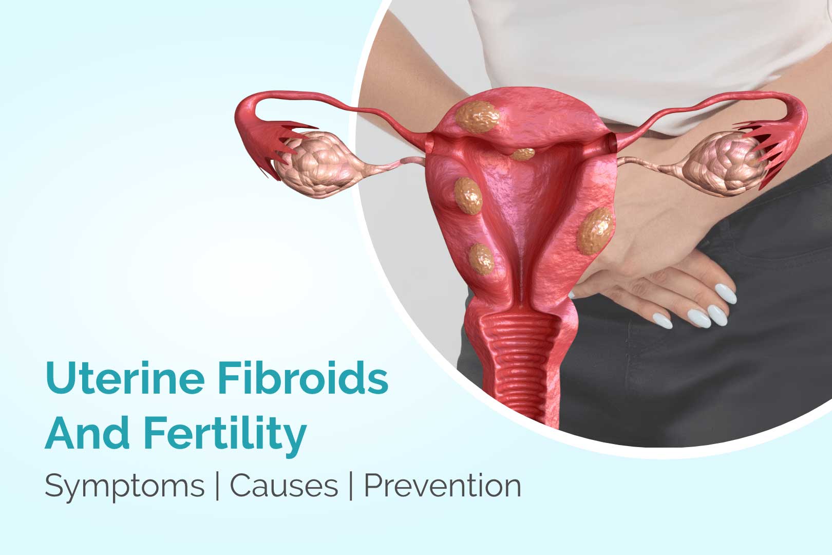 addressing uterine fibroids a significant factor impacting women’s fertility in their 30s